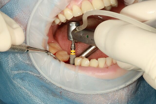 denture